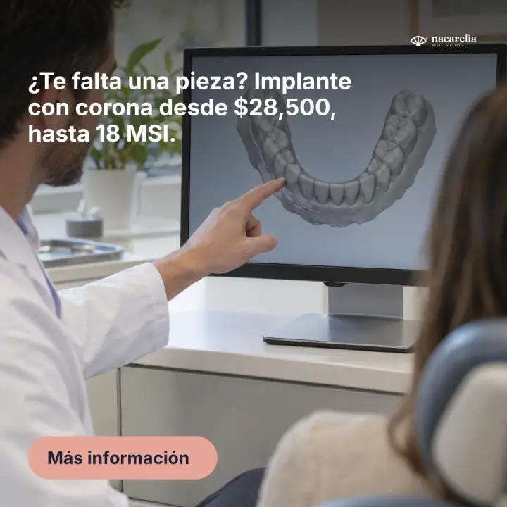 Anuncio: ¿Te falta una pieza? Implante con corona desde $28,500.